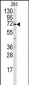 MIPEP Antibody (Center)